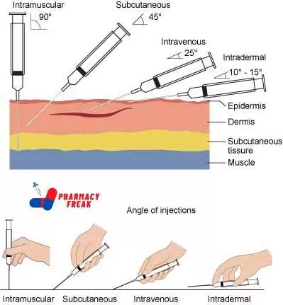 INJECTIONS