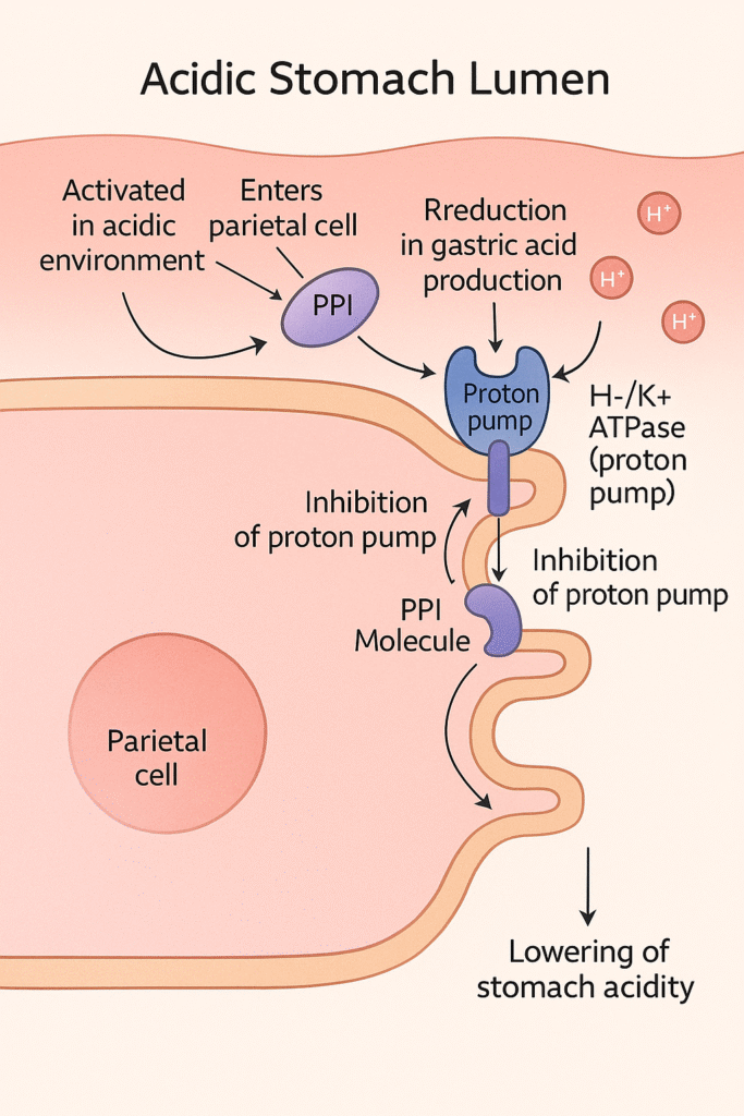 Mechanism of action of proton pump inhibitors (PPIs) showing PPI activation, binding to H+/K+ ATPase in parietal cells, and inhibition of gastric acid secretion