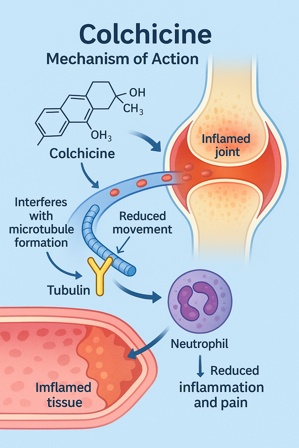 Mechanism of action of Colchicine showing tubulin binding, microtubule disruption, and inhibition of neutrophil migration in inflamed joints.