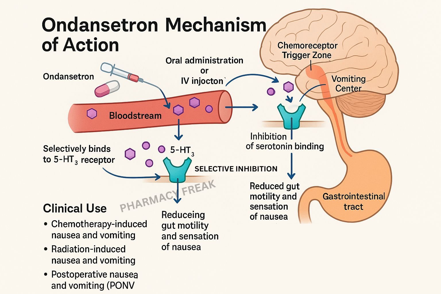Ondansetron Mechanism of Action