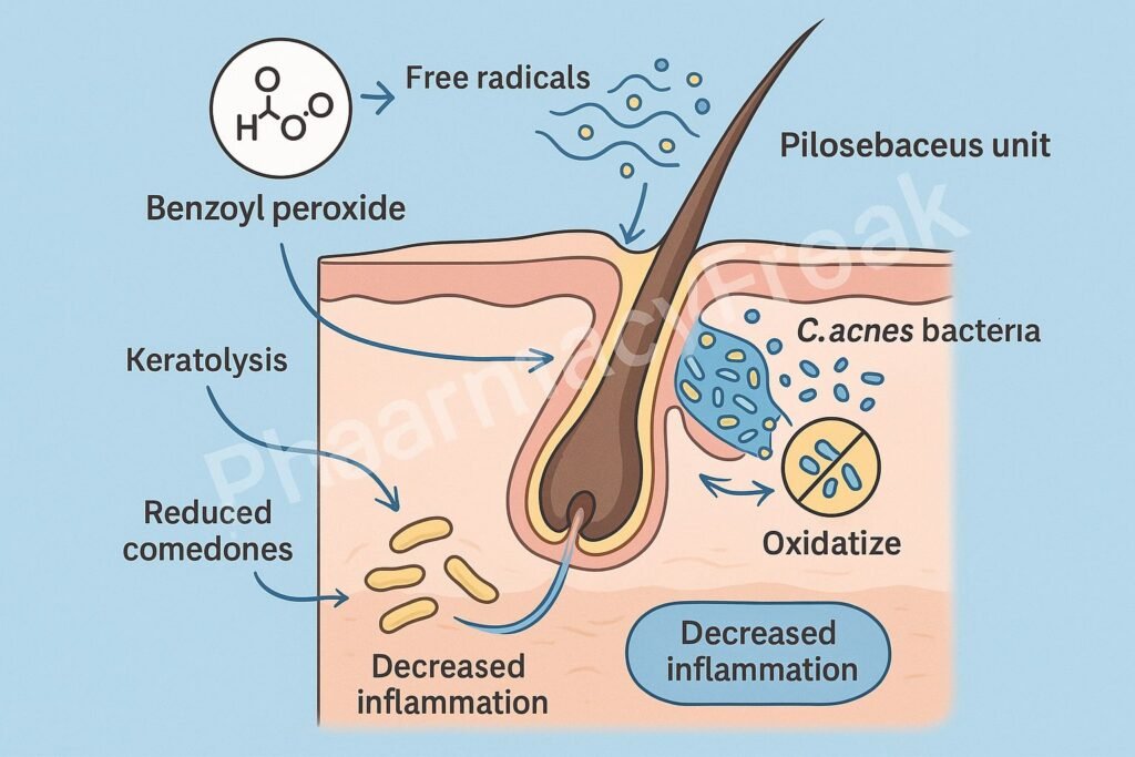 Benzoyl peroxide acne treatment mechanism