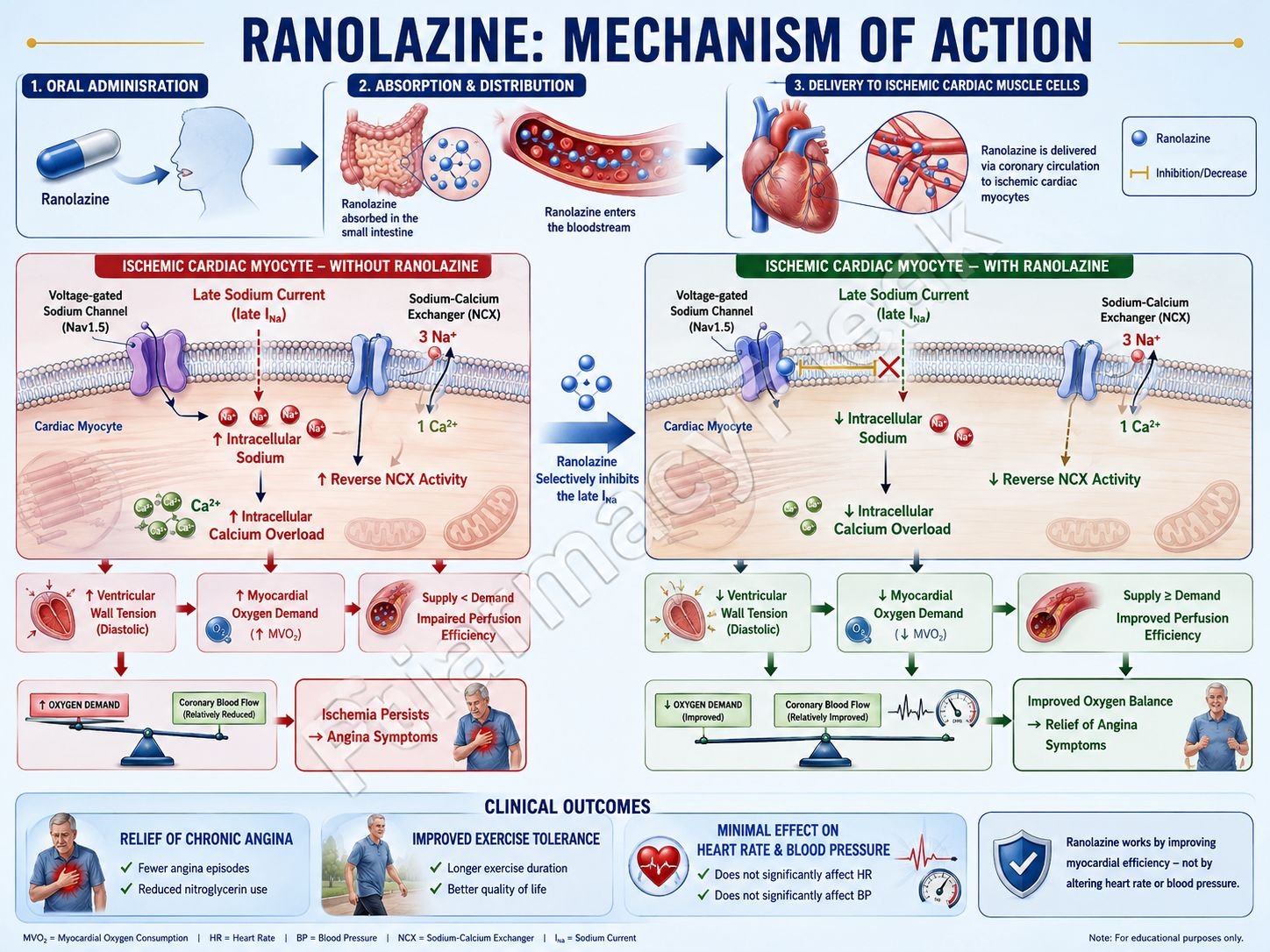 Mechanism of action of Ranolazine