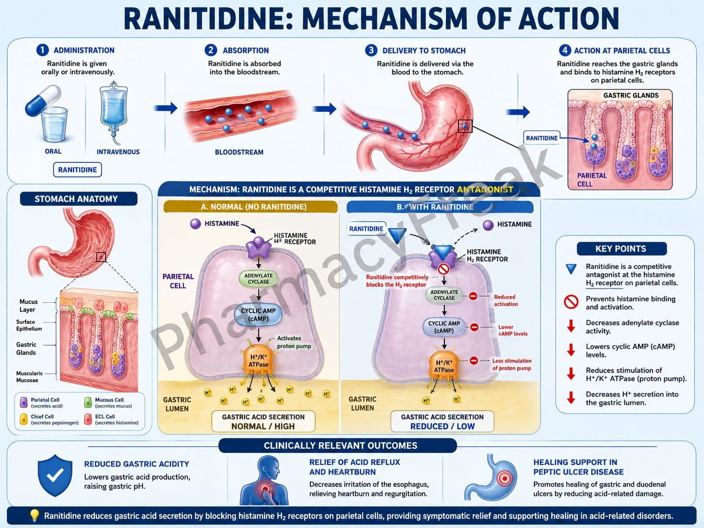 MOA of Ranitidine